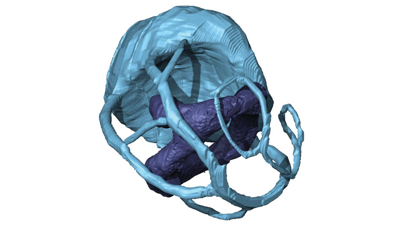3D serial block face scanning electron microscopy image of a baculovirus-infected insect cells