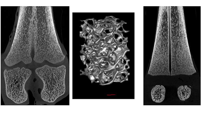 Metatarsal bone from normal and thyroid-deficient ovine fetuses using micro-computed topography