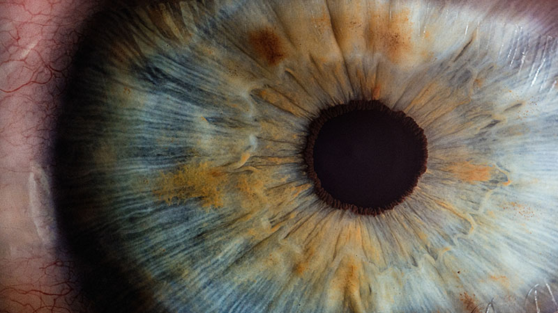 Funding boost for pioneering eye genetics research
