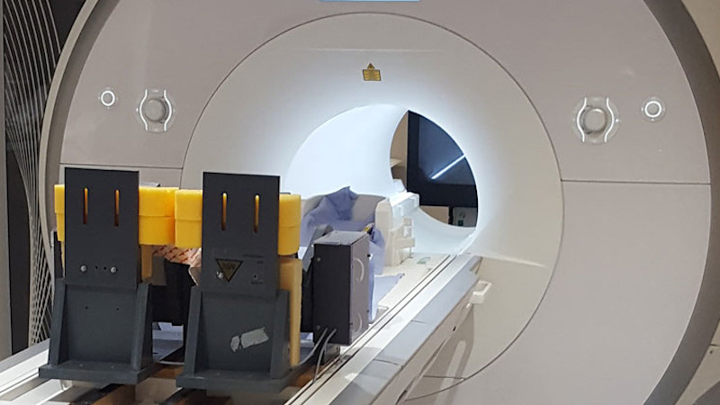 MRI scanner ready for in-scanner motion task for children with developmental coordination disorders