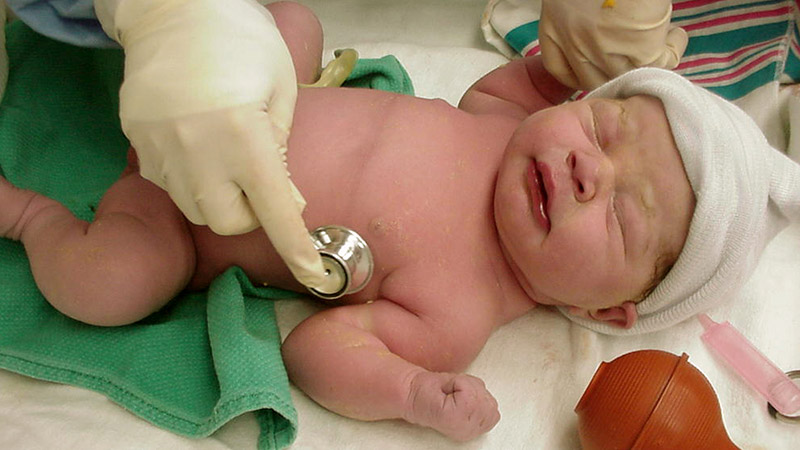 Healthcare professional assessing newborn